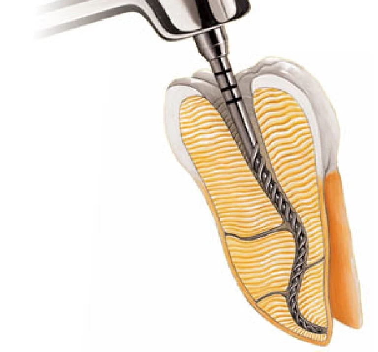 endodoncja